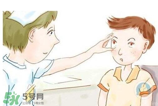 紅眼病用什么眼藥水好？紅眼病吃什么好得快