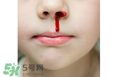 一哭就流鼻血是怎么回事 流鼻血是什么原因 一哭就流鼻血是怎么回事 流鼻血是什么原因