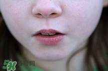 一哭就流鼻血是怎么回事 流鼻血是什么原因 一哭就流鼻血是怎么回事 流鼻血是什么原因