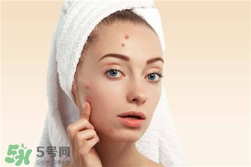 激光祛痘印有副作用嗎？激光去痘印有后遺癥嗎？