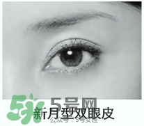 歐式雙眼皮適合什么人 歐式雙眼皮前后對比 歐式雙眼皮適合什么人 歐式雙眼皮前后對比