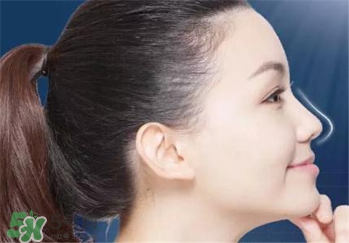 隆鼻會拉近眼距嗎？隆鼻會改變眼睛嗎？