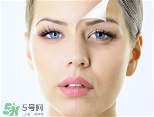 玻尿酸除皺有效果嗎？玻尿酸除皺效果怎么樣？