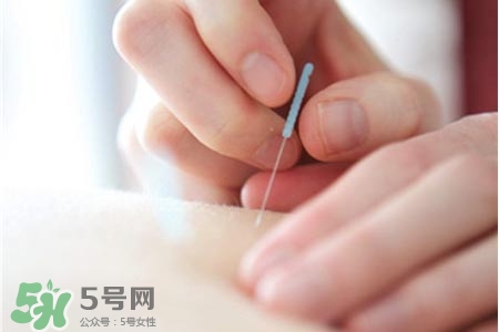 沒病可以針灸嗎？沒病可以扎針嗎？