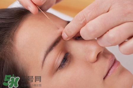 沒病可以針灸嗎？沒病可以扎針嗎？