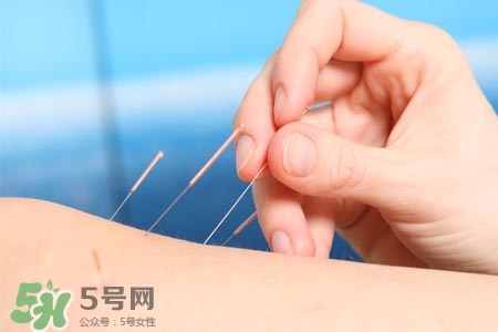 沒病可以針灸嗎？沒病可以扎針嗎？