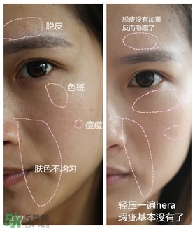 赫拉氣墊用了悶痘嗎？赫拉氣墊悶痘怎么辦？