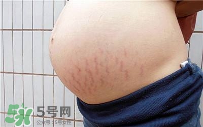 妊娠紋幾個(gè)月開始出現(xiàn)？妊娠紋能消除掉嗎？