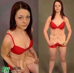 去皺最好的方法 最有效的去皺方法 去皺最好的方法 最有效的去皺方法