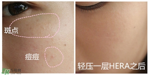 赫拉氣墊用了悶痘嗎？赫拉氣墊悶痘怎么辦？