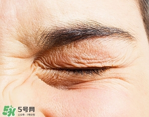 去皺最好的方法 最有效的去皺方法 去皺最好的方法 最有效的去皺方法