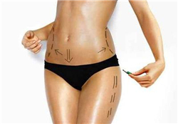 抽脂會(huì)留下疤痕嗎？抽脂會(huì)不會(huì)留疤？