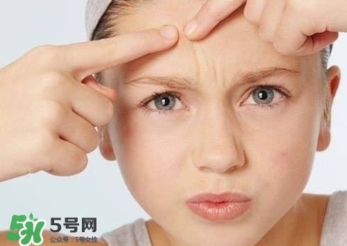 痘印怎么去除 痘印怎么祛除小妙招 痘印怎么去除 痘印怎么祛除小妙招