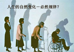 哪些人容易得骨質(zhì)疏松癥？骨質(zhì)疏松的高發(fā)人群有哪些？