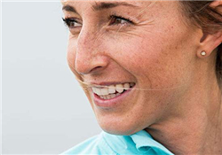 老年斑是怎么形成的？老年斑的形成原因