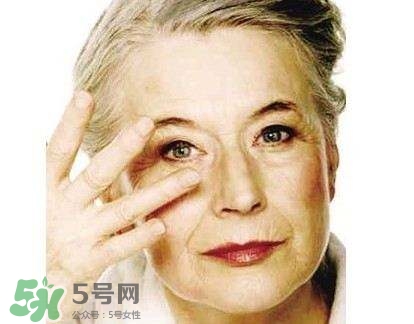 老年斑是怎么形成的？老年斑的形成原因