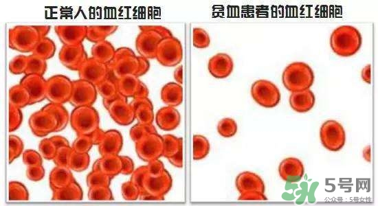 缺鐵性貧血的癥狀 缺鐵性貧血的癥狀有哪些？