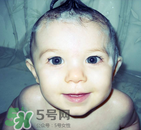 皮膚變好的方法 皮膚變好的小妙招 皮膚變好的方法 皮膚變好的小妙招