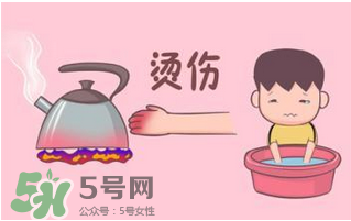 燙傷可以用牙膏嗎？燙傷用牙膏管用嗎？