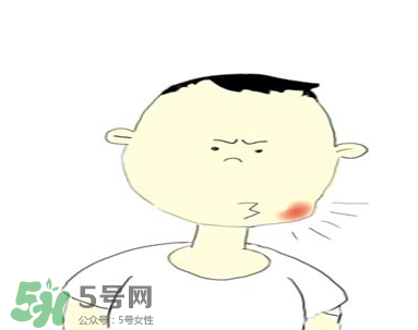 嘴角起泡是什么原因？嘴角起泡怎么辦？