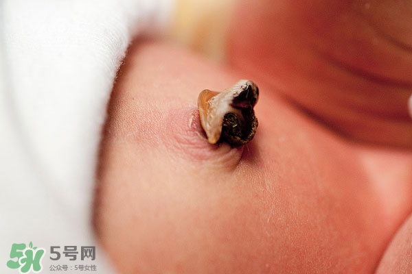 如何清潔寶寶肚臍 寶寶臍帶的護(hù)理方法 如何清潔寶寶肚臍 寶寶臍帶的護(hù)理方法