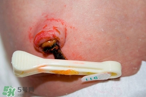 如何清潔寶寶肚臍 寶寶臍帶的護(hù)理方法 如何清潔寶寶肚臍 寶寶臍帶的護(hù)理方法