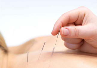 針灸可以治療風(fēng)濕嗎？針灸治風(fēng)濕性關(guān)節(jié)炎效果好嗎？