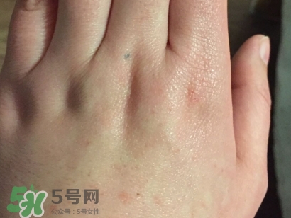 薇諾娜適合什么皮膚？薇諾娜適合敏感肌嗎？