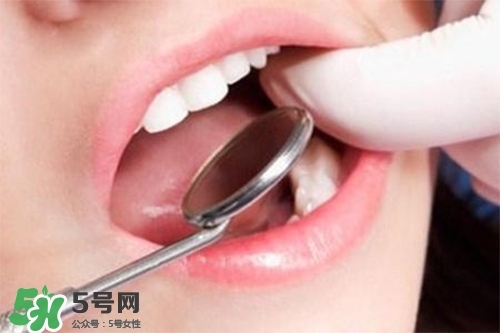 口腔異味是怎么回事？口腔異味怎么清除？