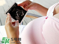 保胎期間可以洗澡嗎？臥床保胎可以洗澡嗎？