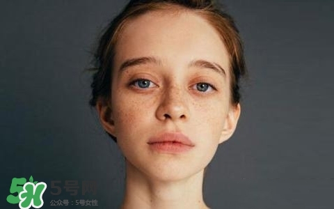 長(zhǎng)斑是什么原因引起的？祛斑效果最好的方法