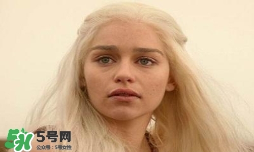 臉色發(fā)黃是什么原因？臉色發(fā)黃吃什么調(diào)理更好？