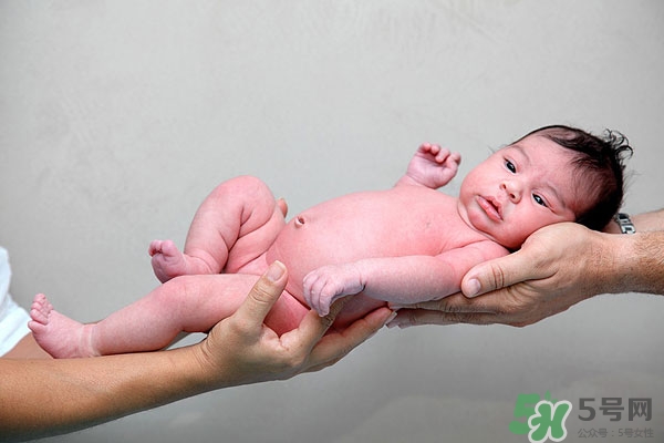 新生兒黃疸高怎么辦 嬰兒黃疸高怎么辦 新生兒黃疸高怎么辦 嬰兒黃疸高怎么辦