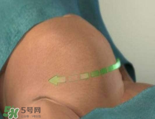 剖腹產的過程 剖腹產的步驟及時間 剖腹產的過程 剖腹產的步驟及時間