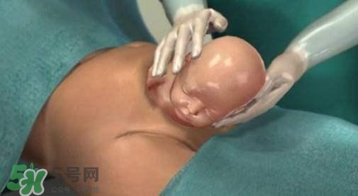 剖腹產的過程 剖腹產的步驟及時間 剖腹產的過程 剖腹產的步驟及時間