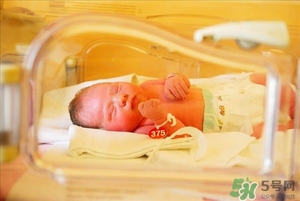 新生兒黃疸高怎么辦 嬰兒黃疸高怎么辦 新生兒黃疸高怎么辦 嬰兒黃疸高怎么辦