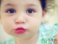 孕期可以激光祛斑嗎？懷孕了能做激光祛斑嗎？