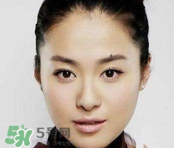 如何預(yù)防臉上長(zhǎng)痣？怎樣預(yù)防臉上長(zhǎng)痣