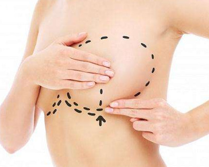 做隆胸手術(shù)對身體有害嗎？隆胸手術(shù)對身體有沒有害