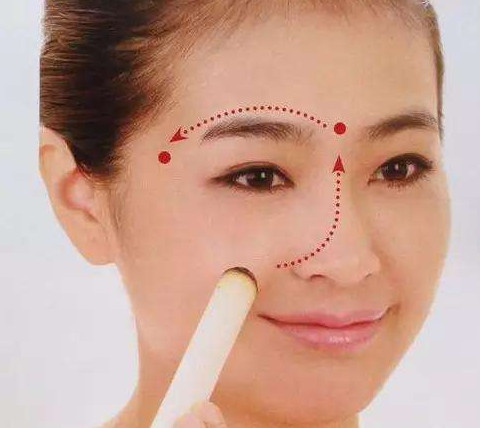 艾灸可以去黑眼圈嗎？艾灸可不可以去黑眼圈