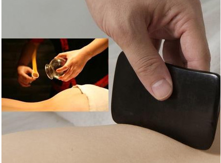 刮痧之后可以拔罐嗎？刮痧之后可不可以拔罐