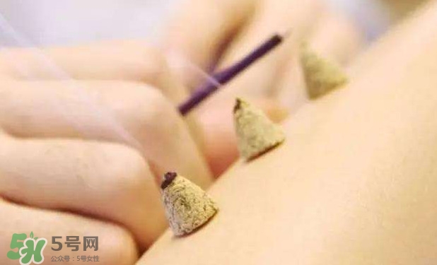 剛懷孕可以艾灸嗎？剛懷孕可以艾灸腹部嗎