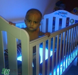 4歲男孩患怪病 終身黃疸是什么病 4歲男孩患怪病 終身黃疸是什么病