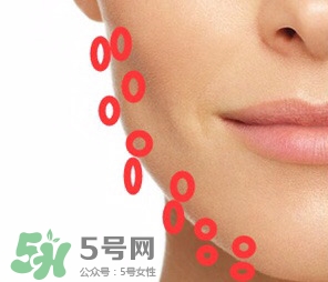 nuface美容儀有效嗎？nuface美容儀副作用？