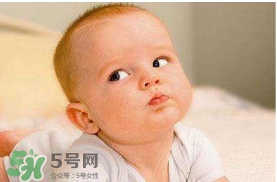 4歲男孩患怪病 終身黃疸是什么病 4歲男孩患怪病 終身黃疸是什么病