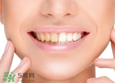 補牙洞用什么材料最好?補牙洞用什么材料結(jié)實? 補牙洞用什么材料最好?補牙洞用什么材料結(jié)實?