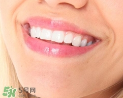 補牙洞用什么材料最好?補牙洞用什么材料結(jié)實? 補牙洞用什么材料最好?補牙洞用什么材料結(jié)實?