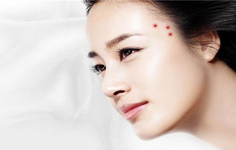 太陽(yáng)穴長(zhǎng)痘怎么回事？為什么太陽(yáng)穴附近會(huì)長(zhǎng)痘