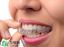 帶牙套的好處和壞處_帶牙套有什么后遺癥 帶牙套的好處和壞處_帶牙套有什么后遺癥
