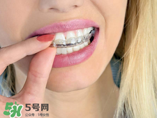 帶牙套的好處和壞處_帶牙套有什么后遺癥 帶牙套的好處和壞處_帶牙套有什么后遺癥